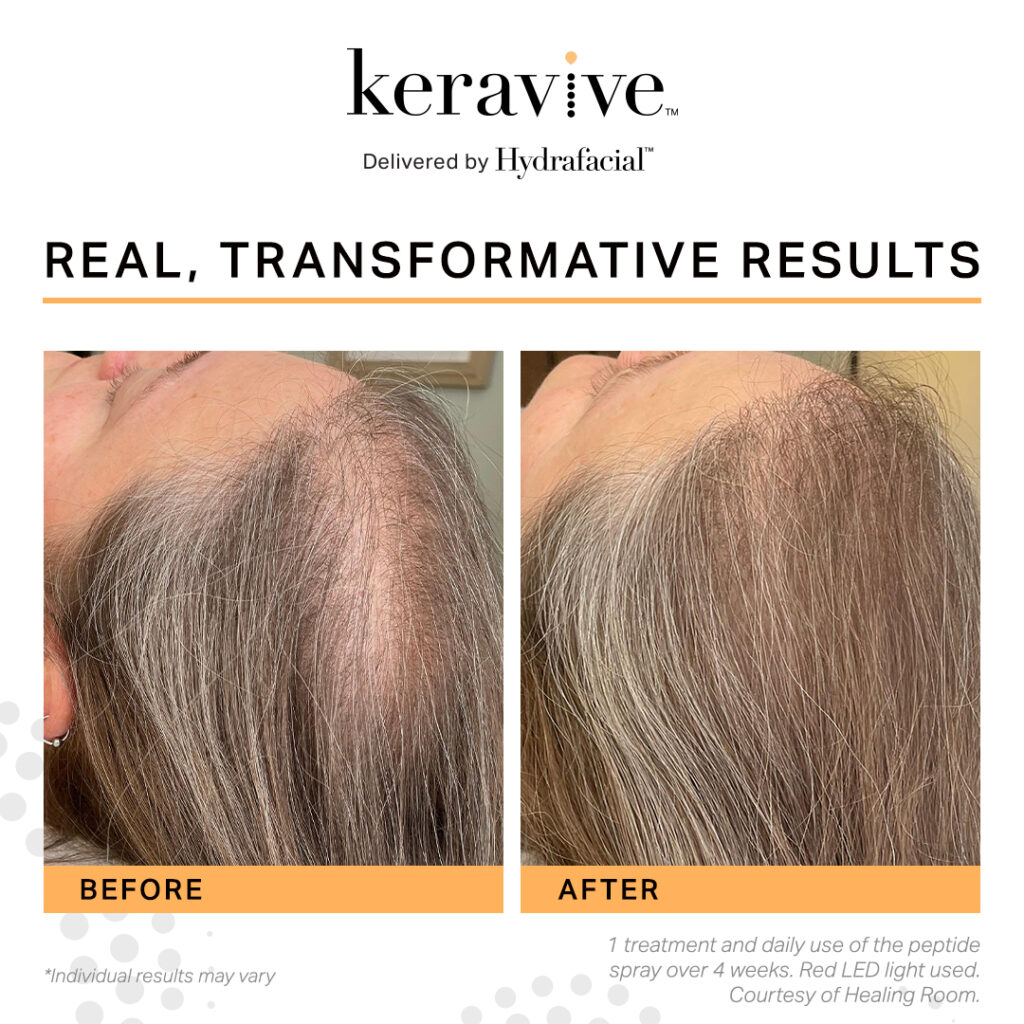 keravive socialposts 6 1024x1024